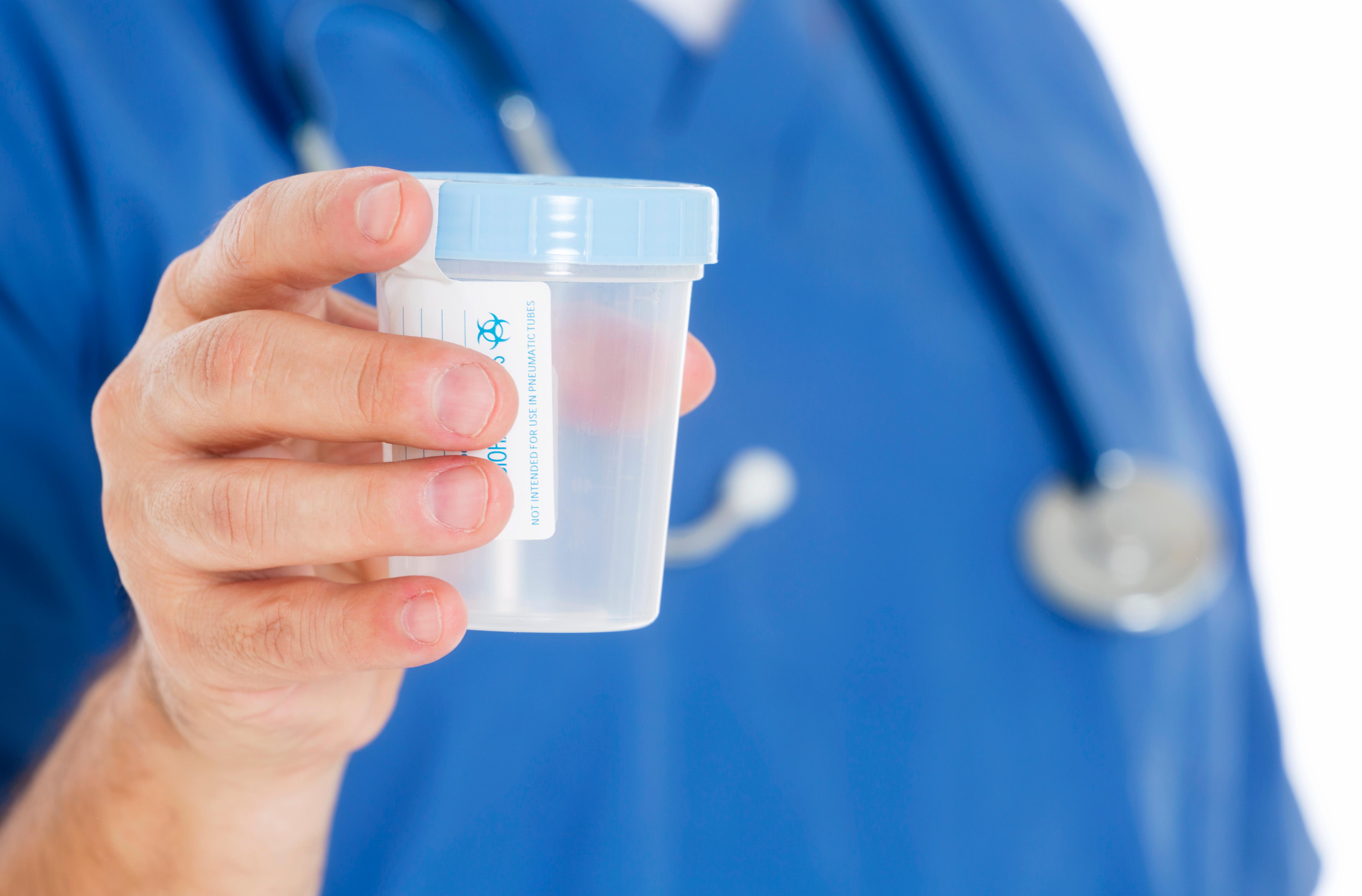How the Latest DOT Drug Testing Changes Affect Employers
